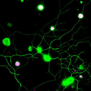 Visualizing pain in mouse sensory neurons (II)