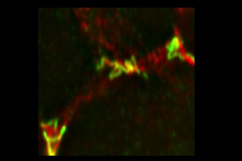 Tricellular & Septate Junctions