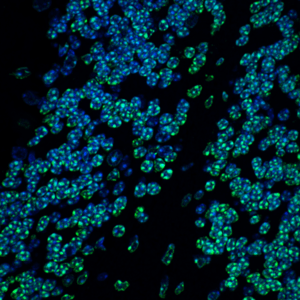 HUSHing repetitive-like elements contributes to normal brain development and function