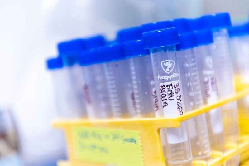 Sample vials in the lab.